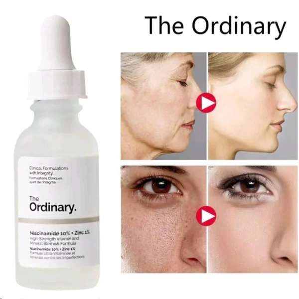 The Ordinary Niacinamide 10% + Zinc 1% Serum – Original | Best for Acne, Oily Skin & Dark Spots in Pakistan - Image 2